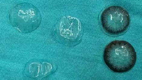 隱眼戴一戴不見了！　以為脫落「眼皮底下去翻出五片」真相曝光