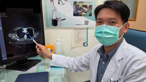 40歲女不菸不咳　健檢X光驚見黑影！竟藏「這種瘤」
