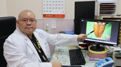 30歲男下體長菜花拖2年　竟冒出103顆！
