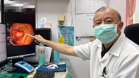 便祕一整天還血便　婦頭暈送醫檢查出大腸癌