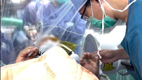 清醒手術助攻　彰基成功執行精準帕金森氏症DBS療法