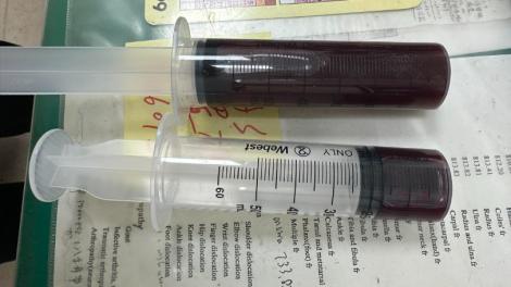 幫病人抽膝蓋血水　家屬「一舉動」讓醫師覺得：我變大谷翔平了