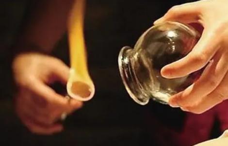 婦人堅持每週「拔罐放血」　沒變健康！醫：嚴重貧血