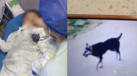 3歲男童被一隻哈士奇「猛烈撕咬」急救住院無效　不幸身亡