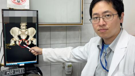 男子「血肉模糊」骨盆爆、腸外露　醫師鬼門關前救人