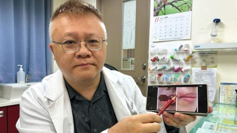 OL遭狗咬下嘴邊肉險毀容！　醫把握黃金6小時這樣做...現奇蹟