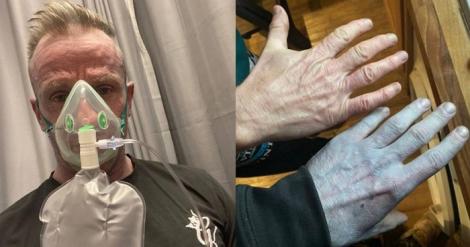 一覺睡醒變成《阿凡達》！　他嚇到衝醫院檢查...結局竟是烏龍一場