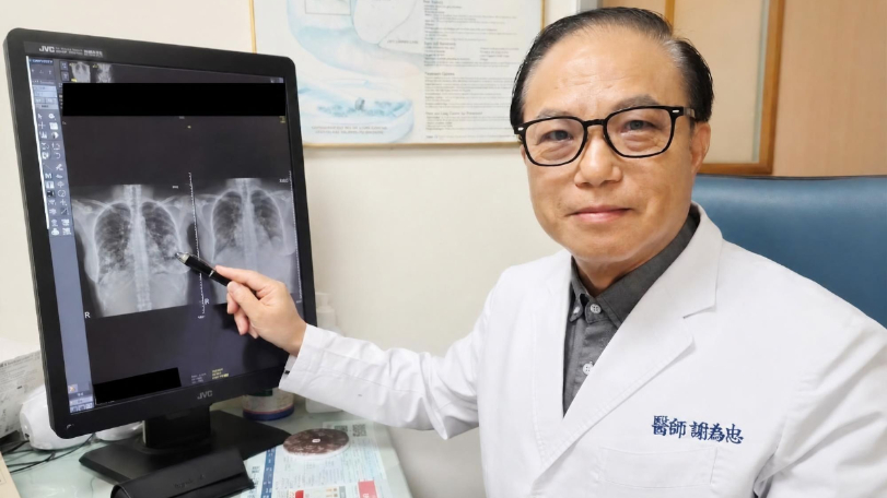 「不吸菸」、「年輕」不代表沒事！　30歲女咳喘2週竟罹肺腺癌四期