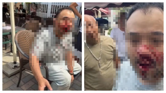 YTR直播吃飯「光頭男一拳拳開扁」！　鏡頭一晃...他整臉都是血