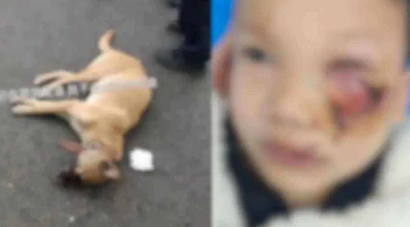 8歲男童遭大狗「撲上狂咬」縫90針慘毀容　狗被活活打死